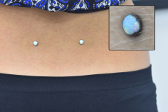Anatometal-Lower-Back-Anchor-Dimples