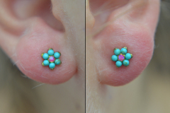 Anatometal-Flower-Lobes