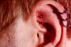 Triple-helix-and-rook