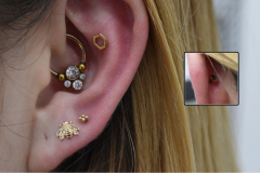Healed-Daith-and-Fresh-Snonch-gold