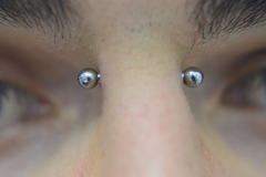 Healed-12g-Bridge