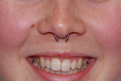 14g-tiny-septum-ti