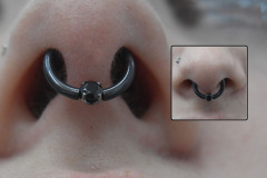 Black-Niobium-Septum-with-Neometal-Captive