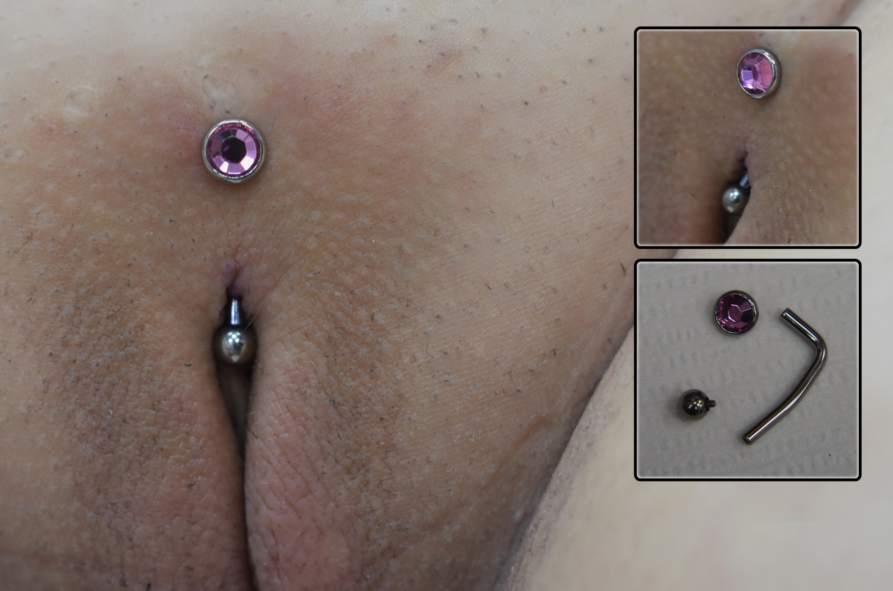 Como cuidar un piercing en el ombligo