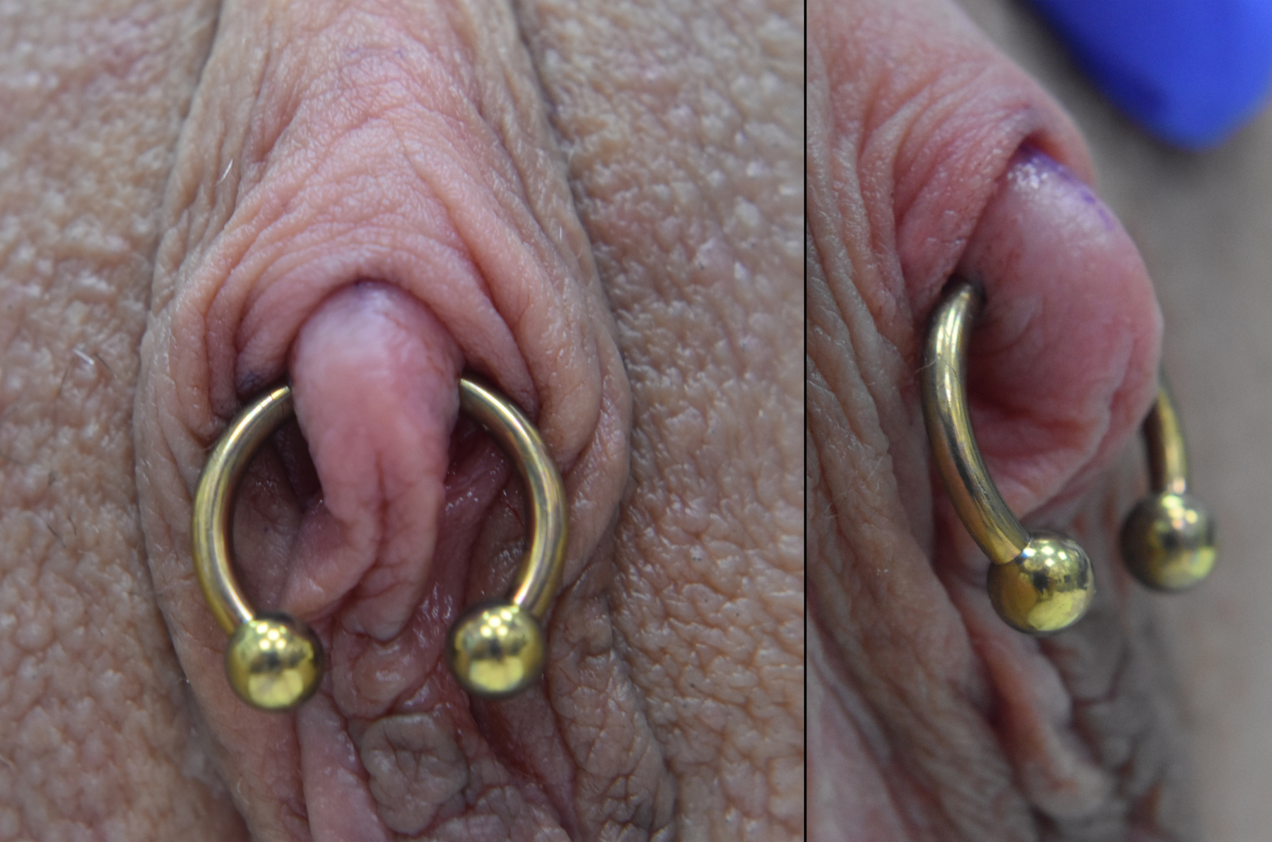 Genital piercing pics