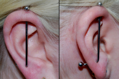 Lobe-to-helix-vertical