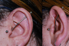 Tragus-to-helix-industrial