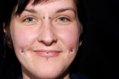 12g-Cheeks-Healed