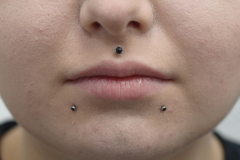 Lowbrets-and-philtrum-neometal