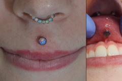 14g-Philtrum-Opal