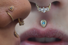 Body-Gems-Philtrum-Healed