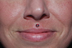 Fire-Opal-Philtrum