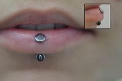 Healed-veritcal-labret