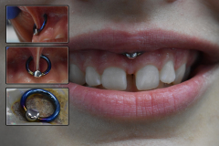 14g-5-16-Smiley-Modified-Bead