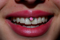 Pink-opal-smiley