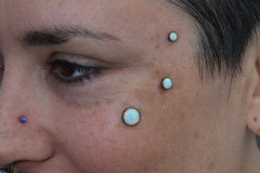 Triple-opal-anchors-under-eye