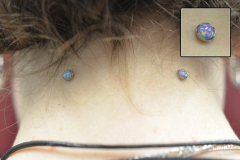 Nape-Anchors-with-Anatometal-Cabs