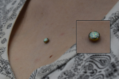 Healed-Chest-Anchor-White-Opal