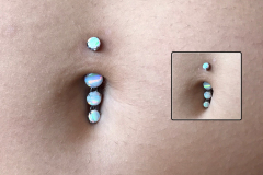 Intrinisic-Dangle-Opal-Navel-Healed