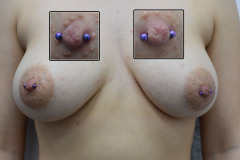 12g-Purple-nipples