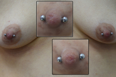 Diagonal-12g-Female-Nipples