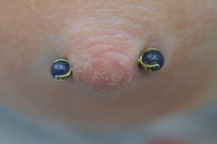 Healed-Gold-Stone-Nipple